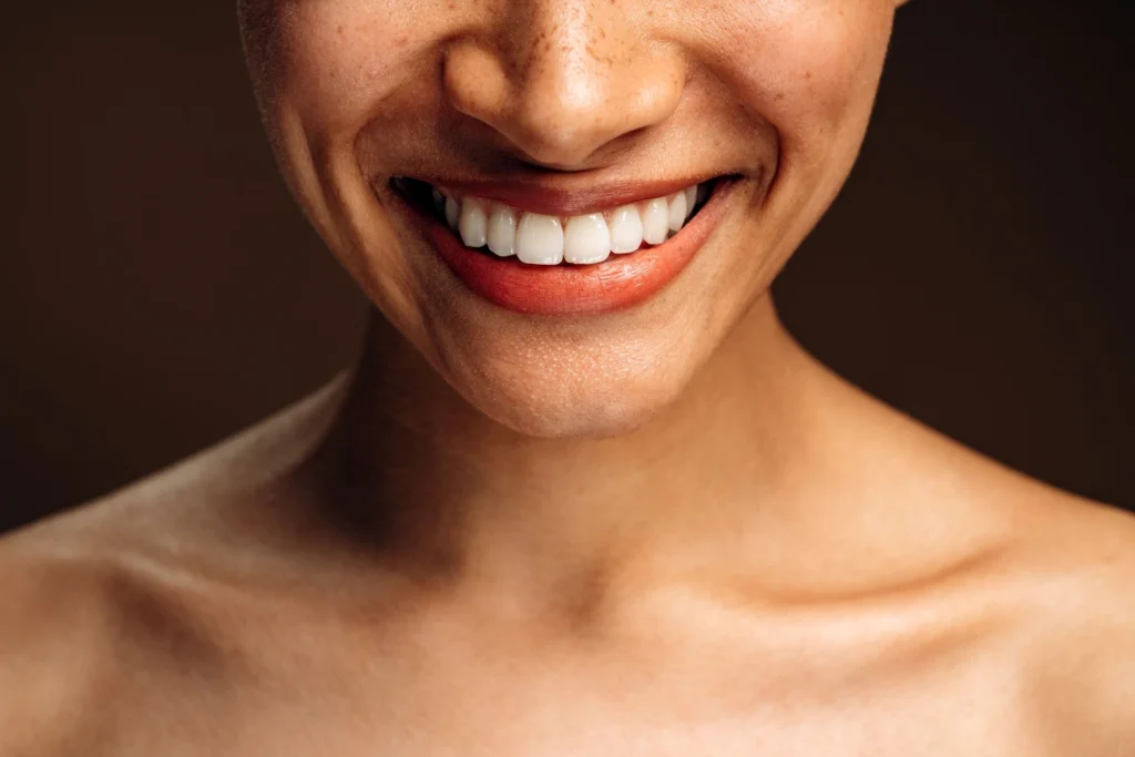 Close-up of a woman smiling with smooth, even teeth maintained with a night guard from Southtown Family Dental in Kansas City, MO.