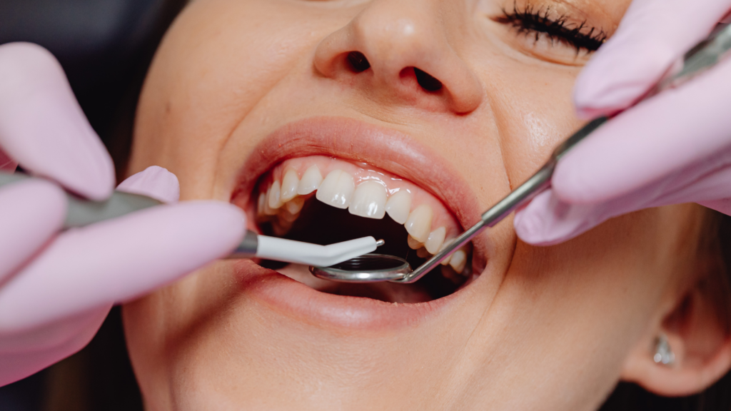 Close up of female patient getting a dental cleaning in Kansas City MO